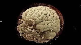 Brain3D