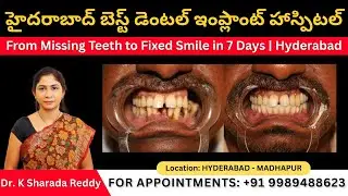 Adilabad Patient Gets All on 6 Dental Implants in Hyderabad, Best Hospital for Fixed Teeth Treatment