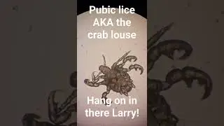 #Pubic #lice are not that common due to deforestation of their natural habitat.  easy to treat.