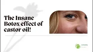 The Insane Botox effect  of castor oil! #botox