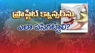 ప్రోస్టేట్ క్యాన్సర్ ను ముందే పట్టుకునేదెలా?  | How to Detect Prostate Cancer Early? | Sukhibhava
