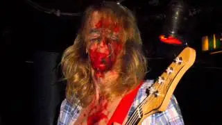 Morbus Chron 