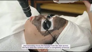 How to Do Treatment with The 2-In-1 Picosecond 808 Diode Laser Hair Removal Machine | HR-AS64