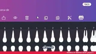 BGS | TUTORIAL INSTALACI&Oacute;N SENSOR RVG CON IA (XPECT VISION)
