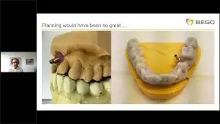 BEGO Implant Systems &ndash; Webinar &ndash; Guided Surgery with BEGO Guide From theory... (język angielski)