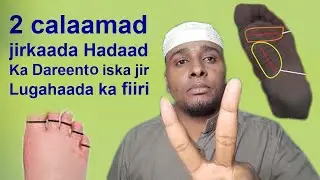 2 calaamad jirkaada Hada ku aragto iska jir arintan Ha sahlan is Daba Qabo Lugaha iyo faraha