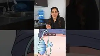 DRAINS WITH YOUR #tummytucksurgery ?🤨 | Saber Plastic Surgery #bodycontouring #tummytuckresults