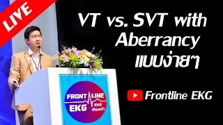 (Live) VT vs SVT with Aberrancy แบบง่ายๆ