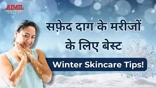 The Ultimate Winter Skincare Guide for Vitiligo Patients!