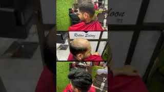 12,000 hair patch monofilament #hairpatch #wigs #hairpatchfixing #nonsurgicalsolutions #hairloss