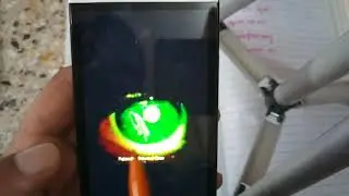 DRY EYE SYNDROME or KERATOCONJUNCTIVITIS SICCA with EXTREMELY IMPORTANT PAPER QUESTION lecture 8