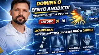COMO USAR O EFEITO AN&Oacute;DICO NOS EXAMES DE RAIO-X. 