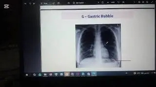 Anatomy (chest) part 2