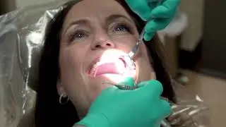 No-Prep Veneers: Conservative Treatment for Impressive Results