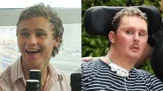 He ate a slug on a dare, became paralyzed and died