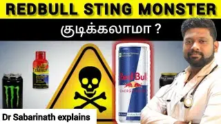 REDBULL Sting Monster - Energy drinks குடிக்கலாமா ? Dr Sabarinath Ravichandar MD DNB pulmonologist |