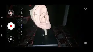Ear Examination Procedure Guide