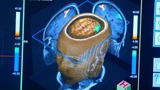 Remapping a Damaged Mind
