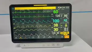 Patient monitor for ICU, OT, POD, NICU, HDU, Post up available in stock