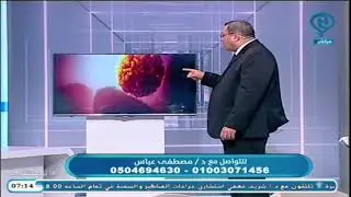 دكتور مصطفى عباس يتحدث عن العقم وأثر الدوالى على الخصوبه على قناة IMC