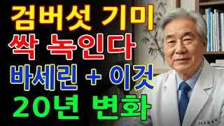 얼굴 덮은 검버섯·기미, 비싼 화장품 필요 없습니다! 3천원 바세린과 ‘이것’ 3방울 – 피부 나이 20년 되돌리는 방법｜기미관리｜주름개선｜피부관리