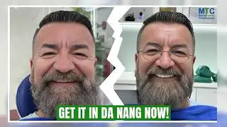 Dental Work in Da Nang, Vietnam: Treatments, Costs, and Timelines!