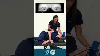 Side lying test for posterior canal BPPV (left side tested here) #vestibularrehabilitation #bppv