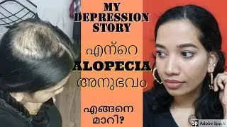 എൻ്റെ ALOPECIA Story I എൻ്റെ Depression Story Iഎങ്ങനെ മാറിI Blush with ASH