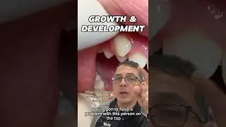 Growth & Development Dental Assessment for Braces | In Office to Hands On Dental Training #shorts