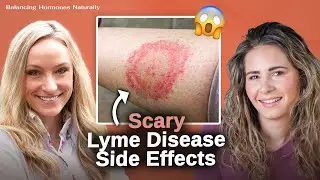 Everything to Know About Lyme Disease: Prevention, Diagnosis, & Treatment | Dr. Casey Kelley
