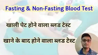 Fasting and Non Fasting Blood Test | Full List | Blood test done on empty stomach and after eating