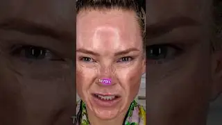 Washing after a TCA PEEL? Day 2: PM TCA skin check #skinpeel