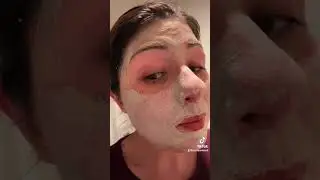 ANCE Masked Out!! how to help calm acne breakouts