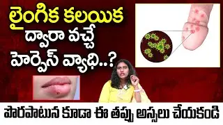 Herpes Simplex Virus | Types, Symptoms And Causes |Treatment And Prevention |Dr Anu Chowdary |iDream