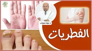 الفطريات أسبابها وطرق علاجها بوصفات طبيعية مع الدكتور عماد ميزاب IMAD MIZAB