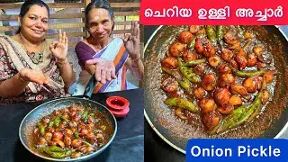ചെറിയ ഉള്ളി അച്ചാർ വായിൽ കപ്പലോടും😋ഇനി മാങ്ങാ അച്ചാർ മാറി നിൽക്കും | Onion Pickle |