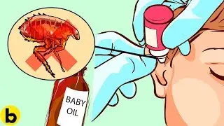 An Insect Flew Into Your Ear, What Should You Do Next?