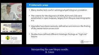 INTERPRETING BREAST BIOPSY RESULTS K  LINOS