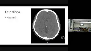 Hiperamonemia e Erros Inatos do Metabolismo