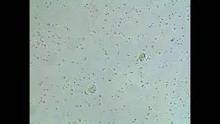 Costia 100x Magnification