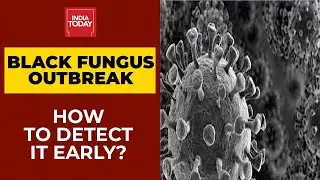 Black Fungus Outbreak: What Are The Symptoms & How To Detect It Early?