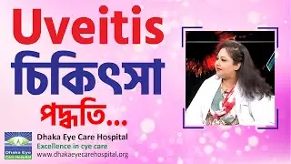 Treatment of Uveitis | Dhaka Eye Care Hospital