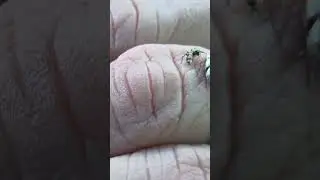 SPIDER the iridescent grain of rice sized missing 3 legs