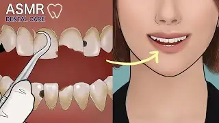 🦷Relaxing Dental Clinic care animation cavity&nbsp;treatment / broken teeth care /scaling