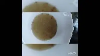 മുടിക്കായ മാറാൻ ഒരു അടിപൊളി homeready 👌how to remove hair tangles easily at home 💯✅👌🫴