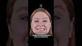 Лицо меняет от брекетов. Нужны ли они тебе - пройди тест в шапке канала #брекеты