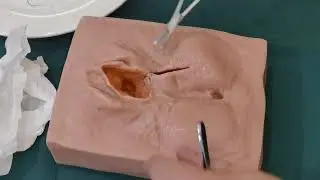 PERINEAL REPAIR