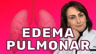 Sa&uacute;de - O que &eacute; Edema Pulmonar? | Ep. 04