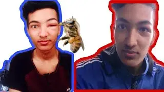BEE ATTACK// never trust bees // Nepali Vlogger