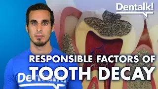 All about CAVITIES - Treatment, prevention and causes of TOOTH DECAY | Dentalk! &copy;